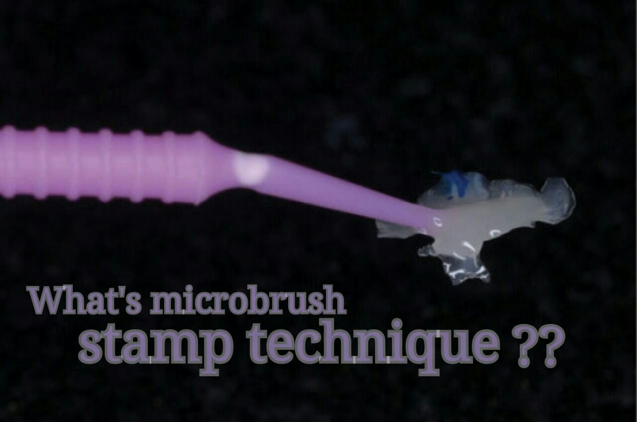 quick-microbrush-stamp-technique-for-composite-restoration-the-dental